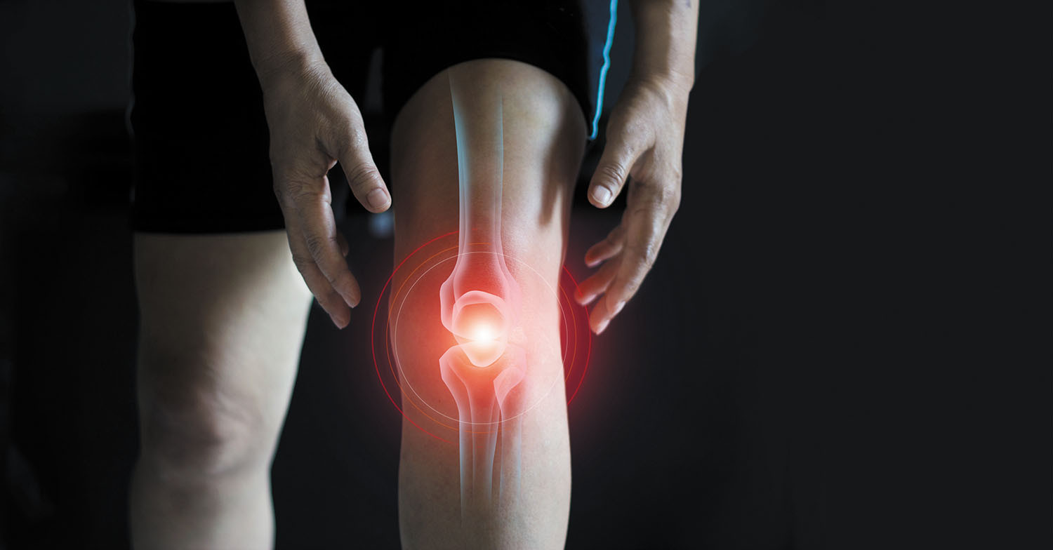 Knieschmerzen verstehen: Warum oft nicht das Knie selbst schuld ist